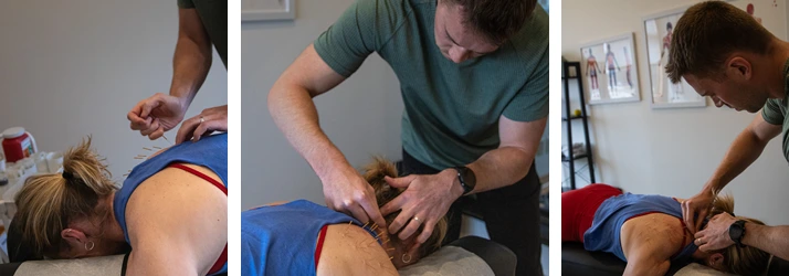 Chiropractor Hudson WI Austin Werdin With Dry Needling Patient Photo grid of a dry needling patient.